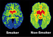 Smoking changes the brain.