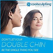 Coolsculpting - Double Chin | University Park Dermatology