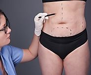 Surgical, Non Surgical Fat Removal Treatments in Whitefield, Koramangala, Bangalore