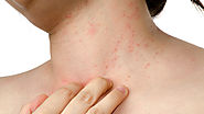 Psoriasis Treatment by Dr. Rinky Kapoor