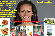 5 Natural Remedies for Vitiligo - How to Treat Vitiligo Naturally