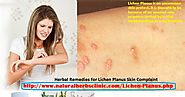 Herbal Remedies for Lichen Planus Skin Complaint