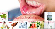 6 Home Remedies for Burning Mouth Syndrome