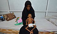Yemen Famine Feared as Starving Children Fight for Lives in Hospital