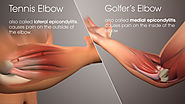Tennis Elbow vs Golfer’s Elbow