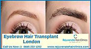 Eyebrow Hair Transplant London UK - rejuvenate hair clinics