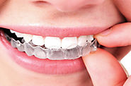 Align your Dental Structure with Invisalign and improved dentist Treatment Technology