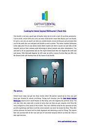 Looking for dental implant Melbourne? Check this by captivatedental