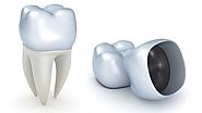 Dental crowns in Melbourne, made of porcelain, strong and natural looking
