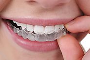 Top Reasons to Choose Invisalign in Melbourne