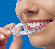 Invisalign Melbourne - An Effective Alternative for Teeth-Straightening Braces | Captivate Dental