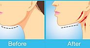 Double Chin Exercises – Learn How To Lose Double Chin And Neck Fat !