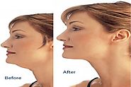10 Quick Exercises To Get Rid Of Your Double Chin
