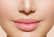 Dermal Fillers capalaba