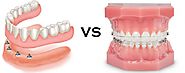 10 Differences between Dental Braces and Dentures | Vita Katy Dentist