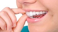 3 Braces that will provide quick and Fastest Result