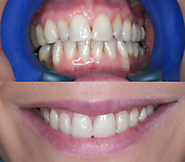 Dentist Blackrock: Your Personal Dentistry!