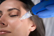 Get Radiant Skin with Microneedling in Astoria, NY