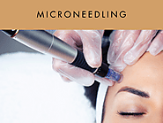Microneedling - The Indy Med Spa