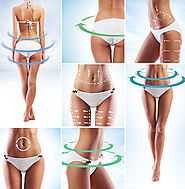 Effectiveness of Liposuction