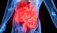 Doença Inflamatória Intestinal: Sintomas e Tratamento | Ciência Online - Saúde, Tecnologia, Ciência