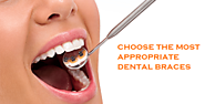 5 Factor that will Help you to Choose the Right Braces | Houston Dental Care