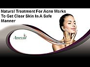 Natural Treatment For Acne Marks To Get Clear Skin In A Safe Manner