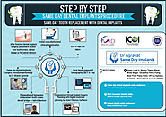 Step by step same day teeth replacement by dental implants procedure