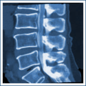 Bone Density Exam - Via Radiology, Seattle WA