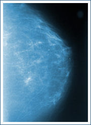 Seattle Mammography, Breast Imaging, Via Radiology