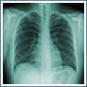 X-Ray Seattle, Digital X Ray, Radiography, Via Radiology
