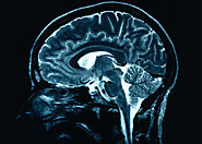 How Do MRIs Work?