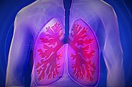 Why Lung Cancer Screening Can Be Lifesaving - News - Via Radiology