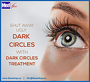 Best Home Remedies Tips To Remove Dark Circles Under Eyes