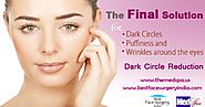 Do You Know About Dark Circles Treatment?