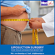 Liposuction in Delhi–All that you need to know