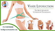Vaser Liposuction in Delhi – An Overview