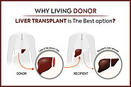 Wondering Why Living Donor Liver Transplant Is The Best Option?