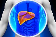 All You Should Know About Liver Transplantation