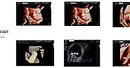 Importance of Taking 3d 4d Ultrasound in Melbourne