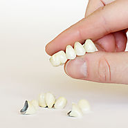 Affordable, Best Dental Crowns in New Friends Colony
