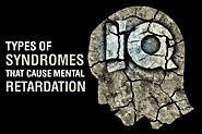 Types of Syndromes That Cause Mental Retardation