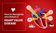 How to Recognize and Detect a Heart Valve Disease – Heart Care Hospitals