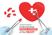 A Short Guide to Understanding Bypass Surgery of the Heart