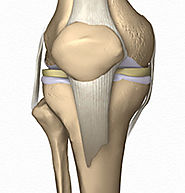 Orthopedic Surgeon from the Best Orthopedic Hospital in India