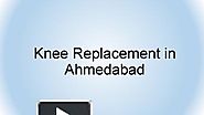 Knee Replacement in Ahmedabad