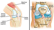 5 Most Common Knee Injuries