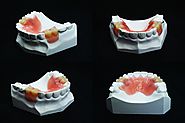Know about denture relines in Sydney