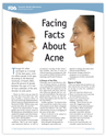 Facing Facts About Acne