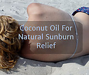 Coconut Oil For Natural Sunburn Relief
